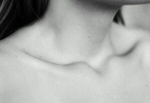 Subtle image of postpartum hormone changes reflected in the female body